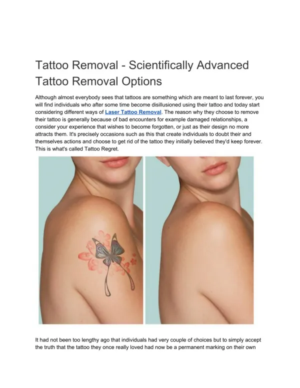 Tattoo Removal - Scientifically Advanced Tattoo Removal Options