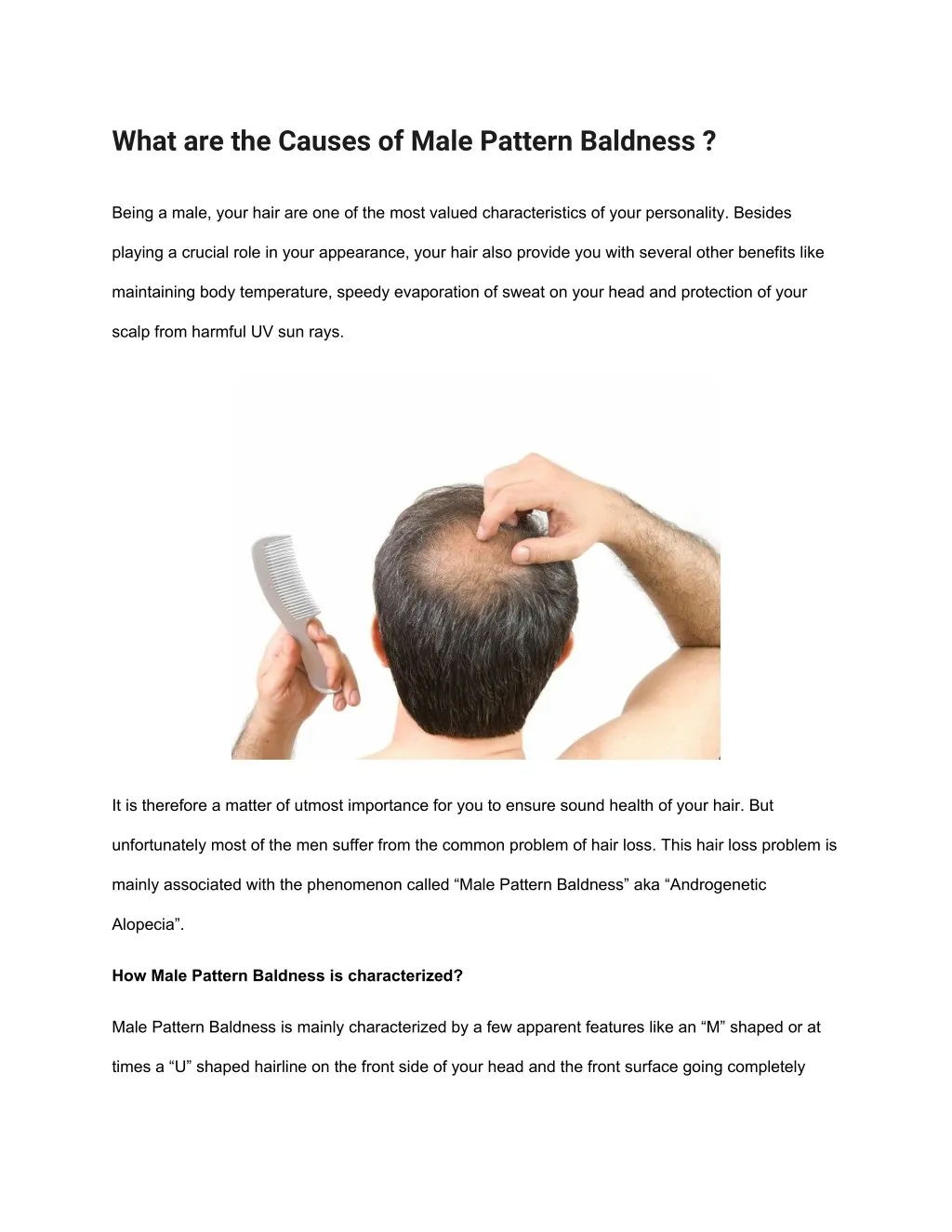 what are the causes of male pattern baldness