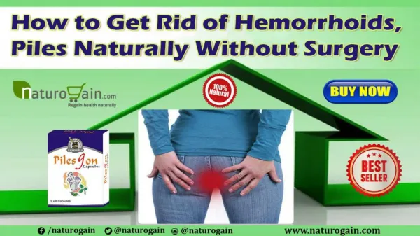 How to Get Rid of Hemorrhoids, Piles Naturally Without Surgery