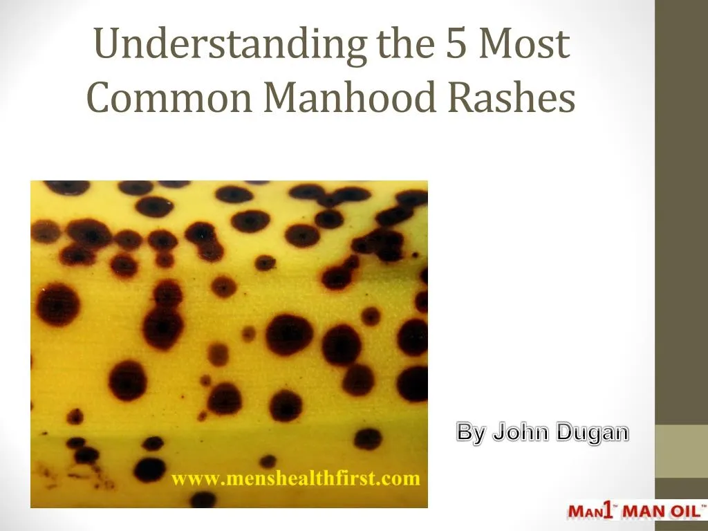 understanding the 5 most common manhood rashes