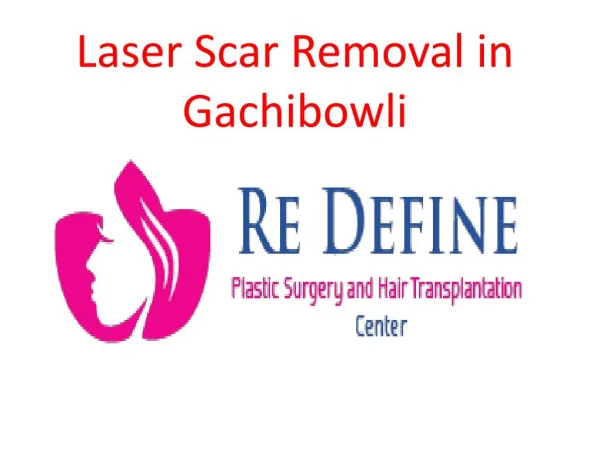 Laser Scar Removal in Gachibowli | Acne Scar Removal Treatment Gachibowli
