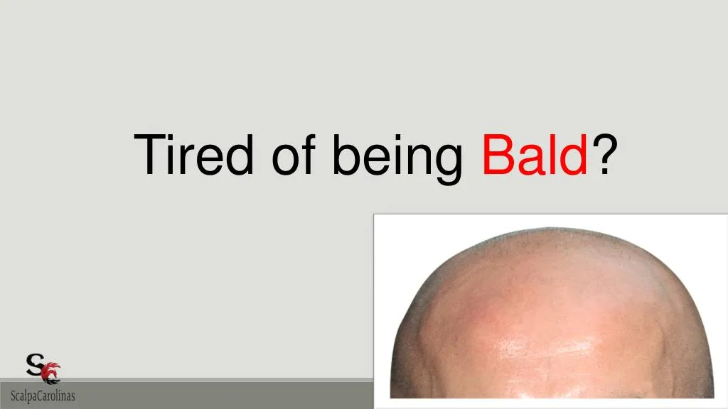 tired of being bald