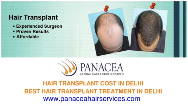 How Hair Is Inserted in Hair Transplant Surgery - Panacea Hair and Skin Services