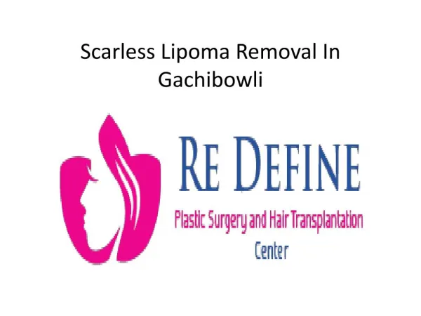 Scarless Lipoma Removal In Gachibowli | Lipoma Removal Clinic Gachibowli