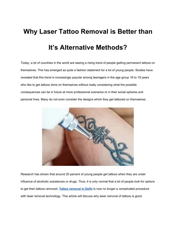 Why Laser Tattoo Removal is Better than It’s Alternative Methods?