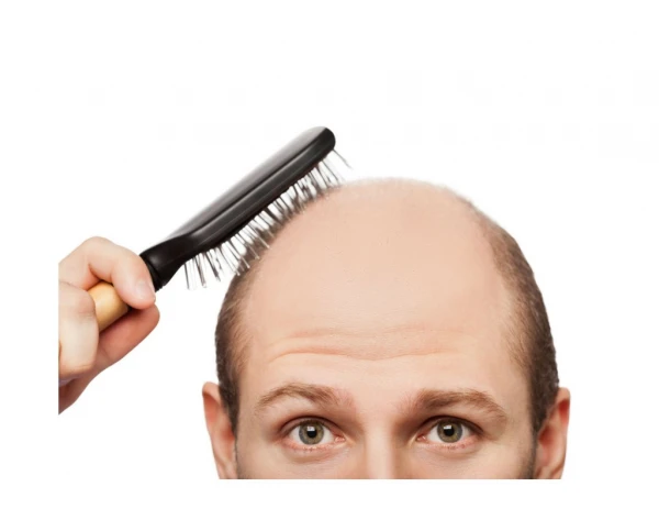 Hair Regrowth Home Remedies, Natural Ways To Stop Hair Loss, Best Medicine For Hair Regrowth