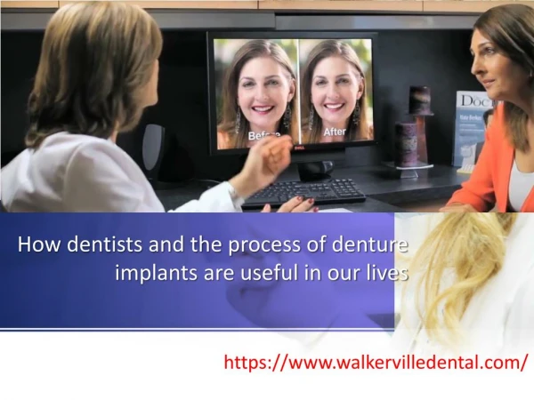 How dentists and the process of denture implants are useful in our lives