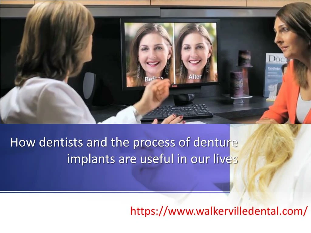 how dentists and the process of denture implants are useful in our lives