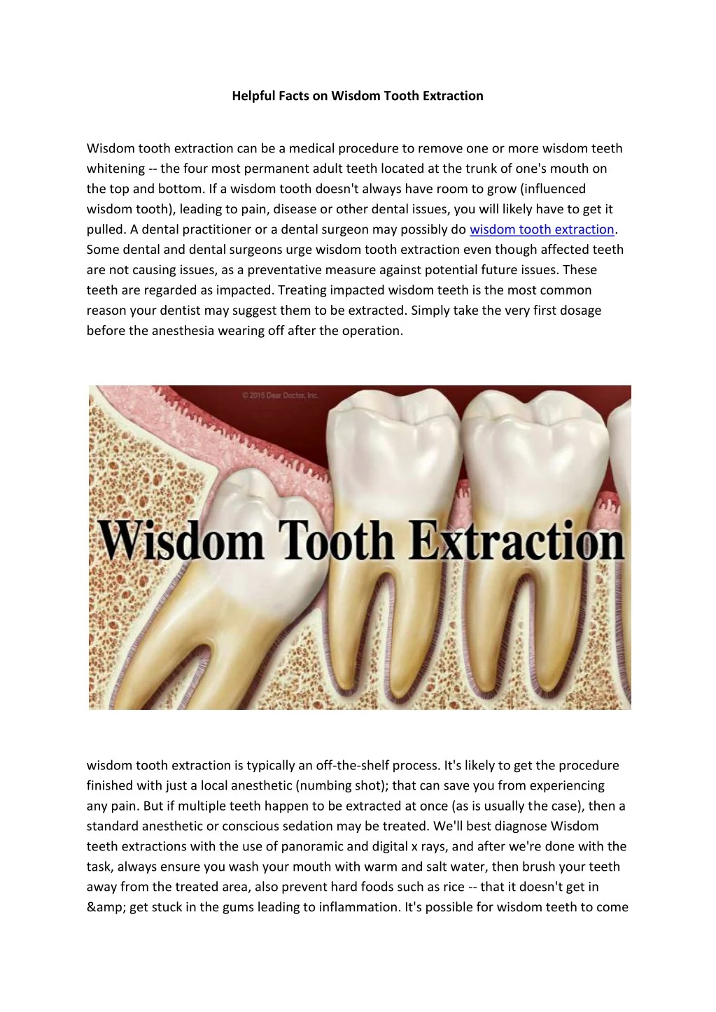 helpful facts on wisdom tooth extraction