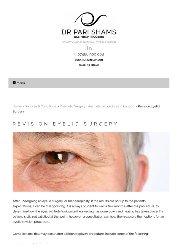 Revision Eyelid Surgery Harley Street | Eyelid Revision Procedure London