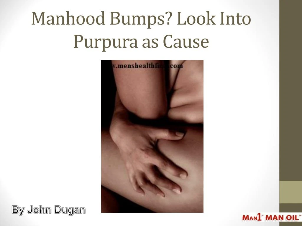 manhood bumps look into purpura as cause