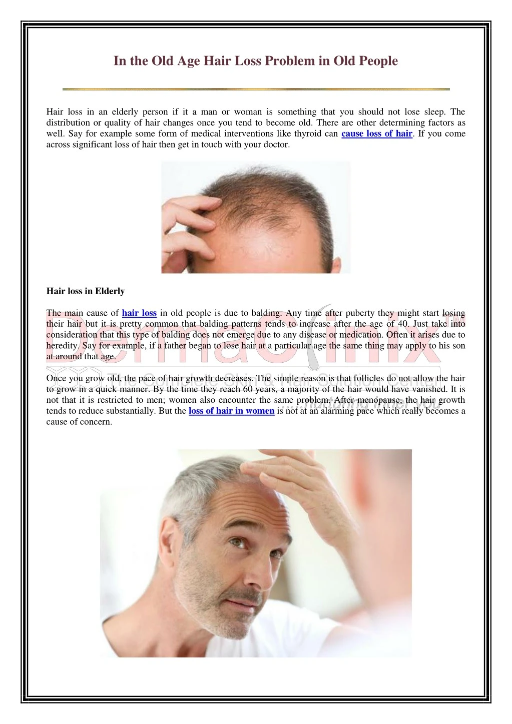 in the old age hair loss problem in old people