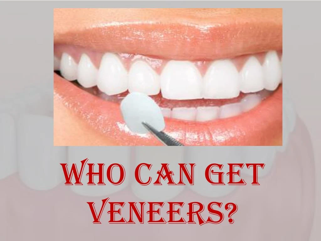 who can get veneers