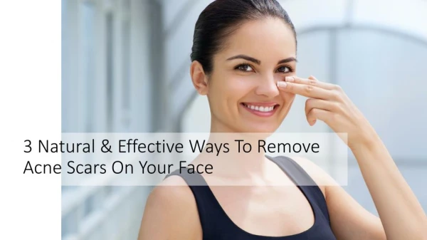 Use these remedies to save your self from acne scars