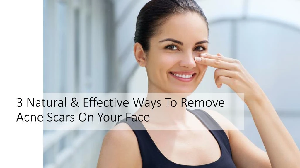 3 natural effective ways to remove acne scars on your face