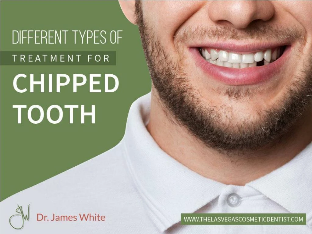 different types of treatment for chipped tooth