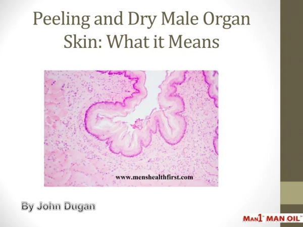 Peeling and Dry Male Organ Skin: What it Means