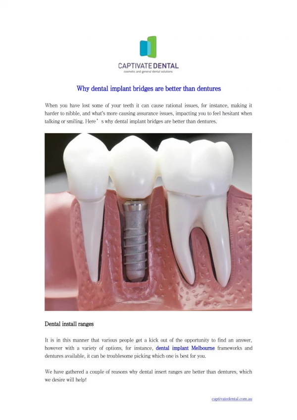 Why dental implant bridges are better than dentures