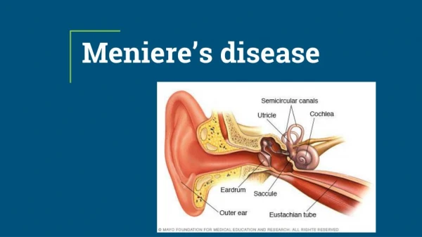 Do You Know Meniere’s disease