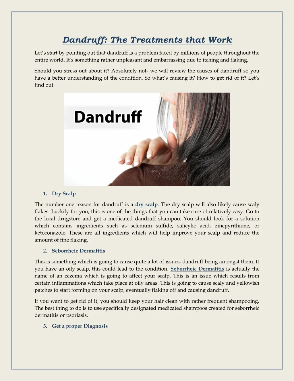 dandruff the treatments that work