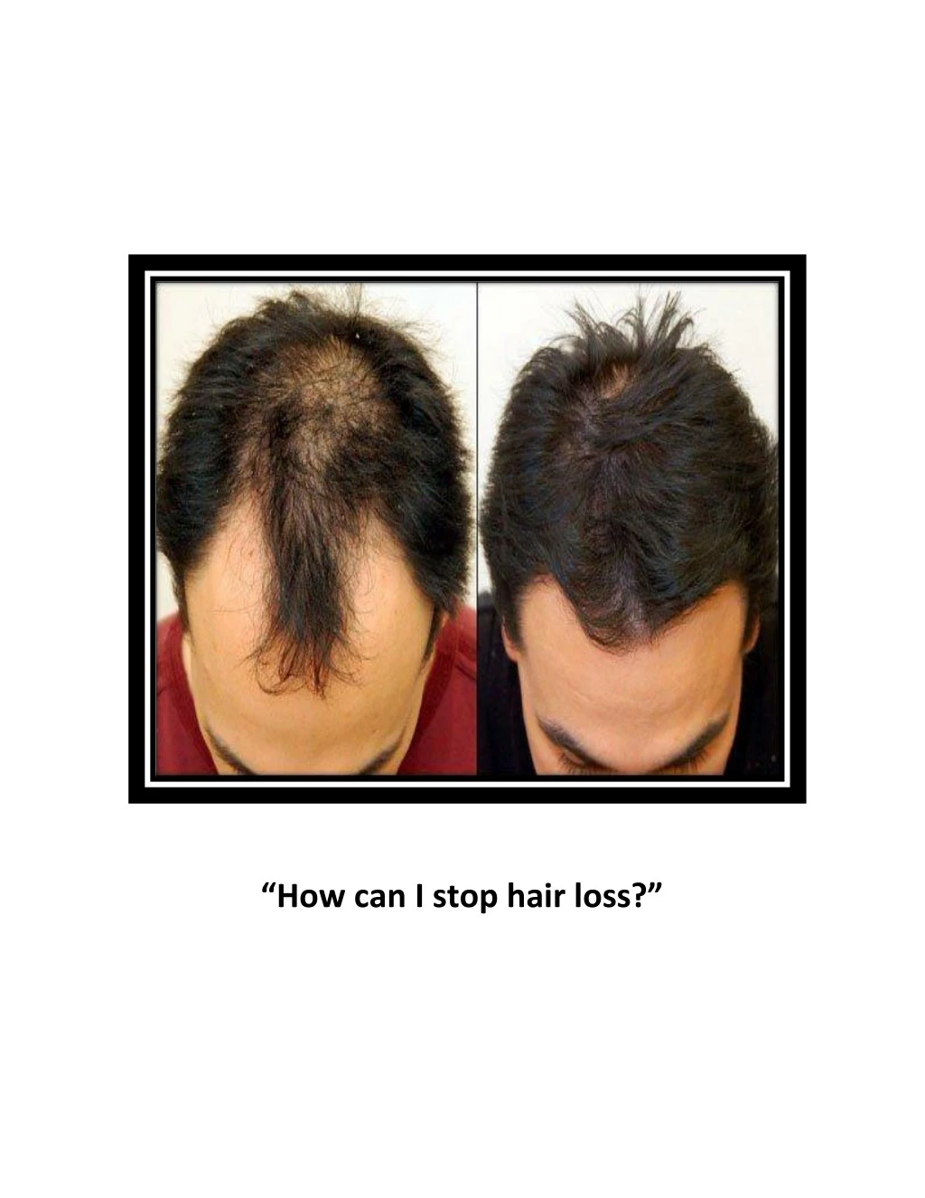 how can i stop hair loss