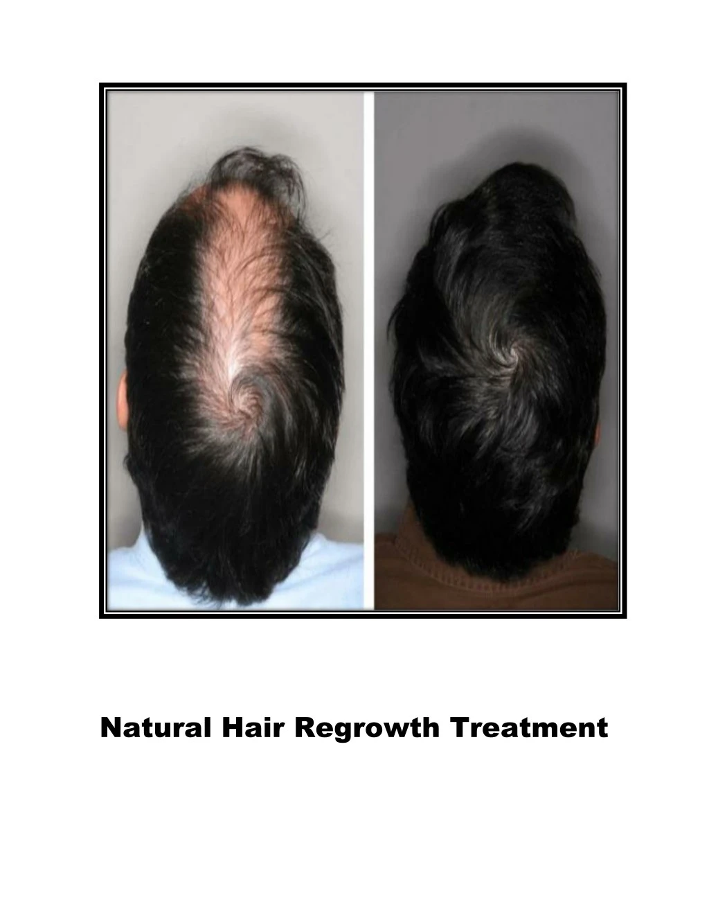 natural hair regrowth treatment