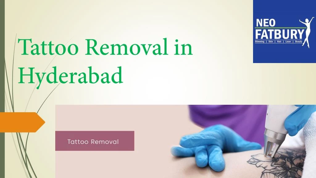 t attoo removal in hyderabad