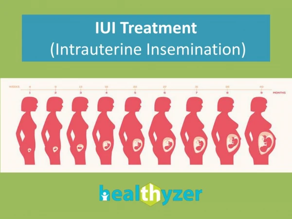 Intrauterine insemination (IUI) treament in Delhi, India | Healthyzer.com