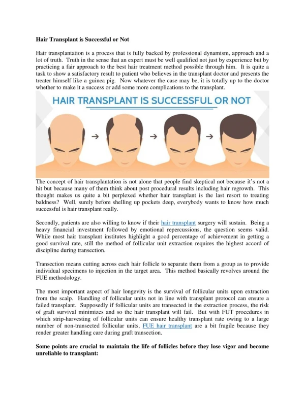 10 Things to consider before having a hair transplant