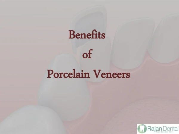 Benefits of Veneers treatment