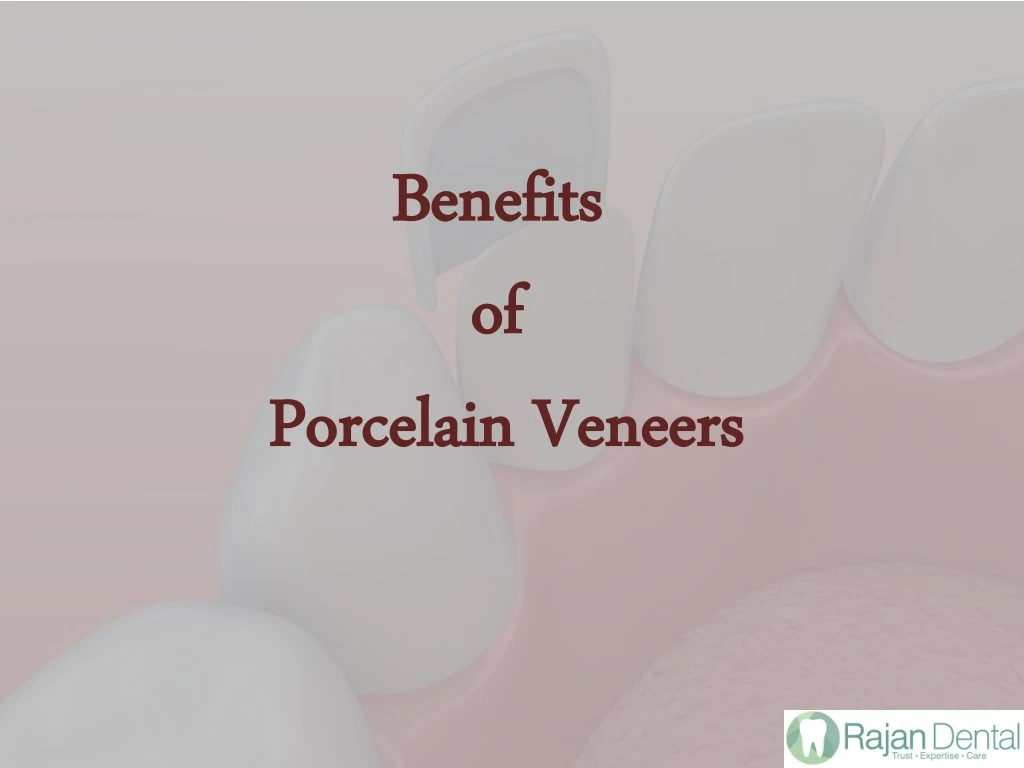 benefits benefits of of porcelain veneers