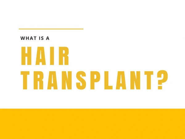 What is a Hair Transplant?