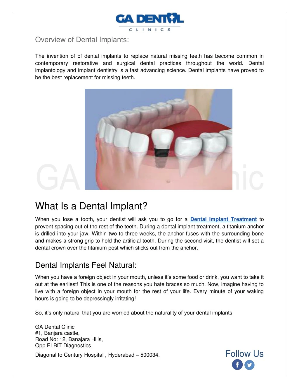 overview of dental implants