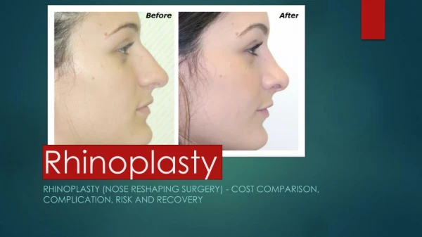 Complete guide for Rhinoplasty,All you need to know about rhinoplasty.