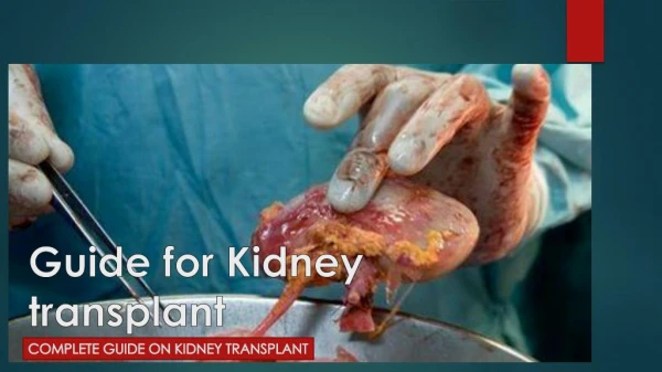 Kidney Transplant - Guide to take Final Decision