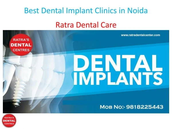 Best Dental Implant Clinics in Noida