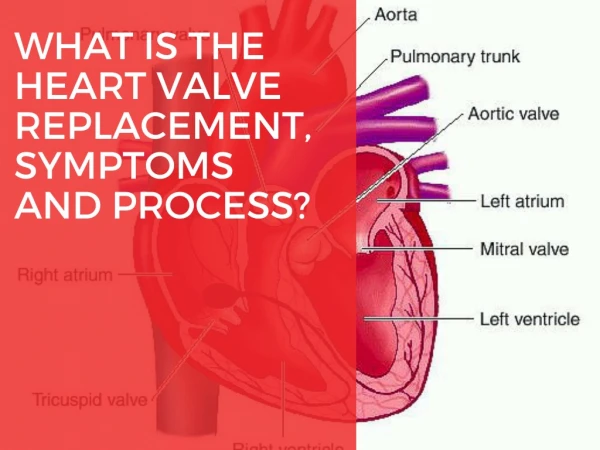 What is the Heart Valve Replacement, Symptoms and Process?