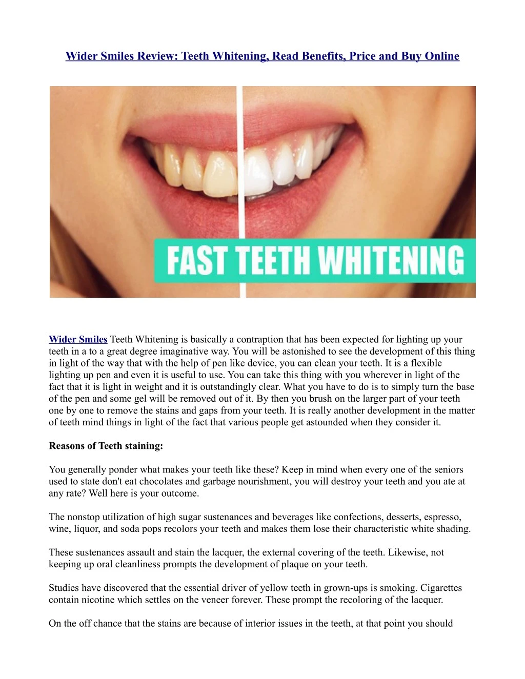 wider smiles review teeth whitening read benefits