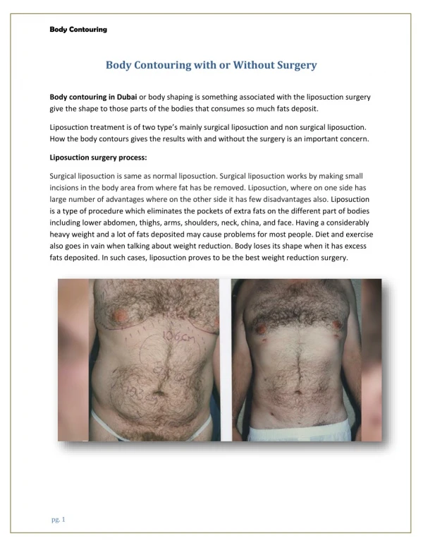 Body Contouring with or Without Surgery