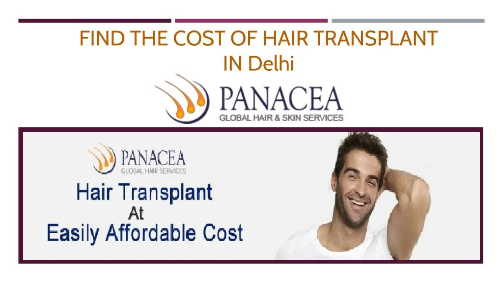 find the cost of hair transplant in delhi