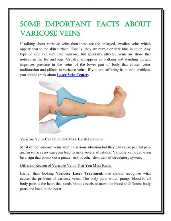 Some Important Facts About Varicose Veins