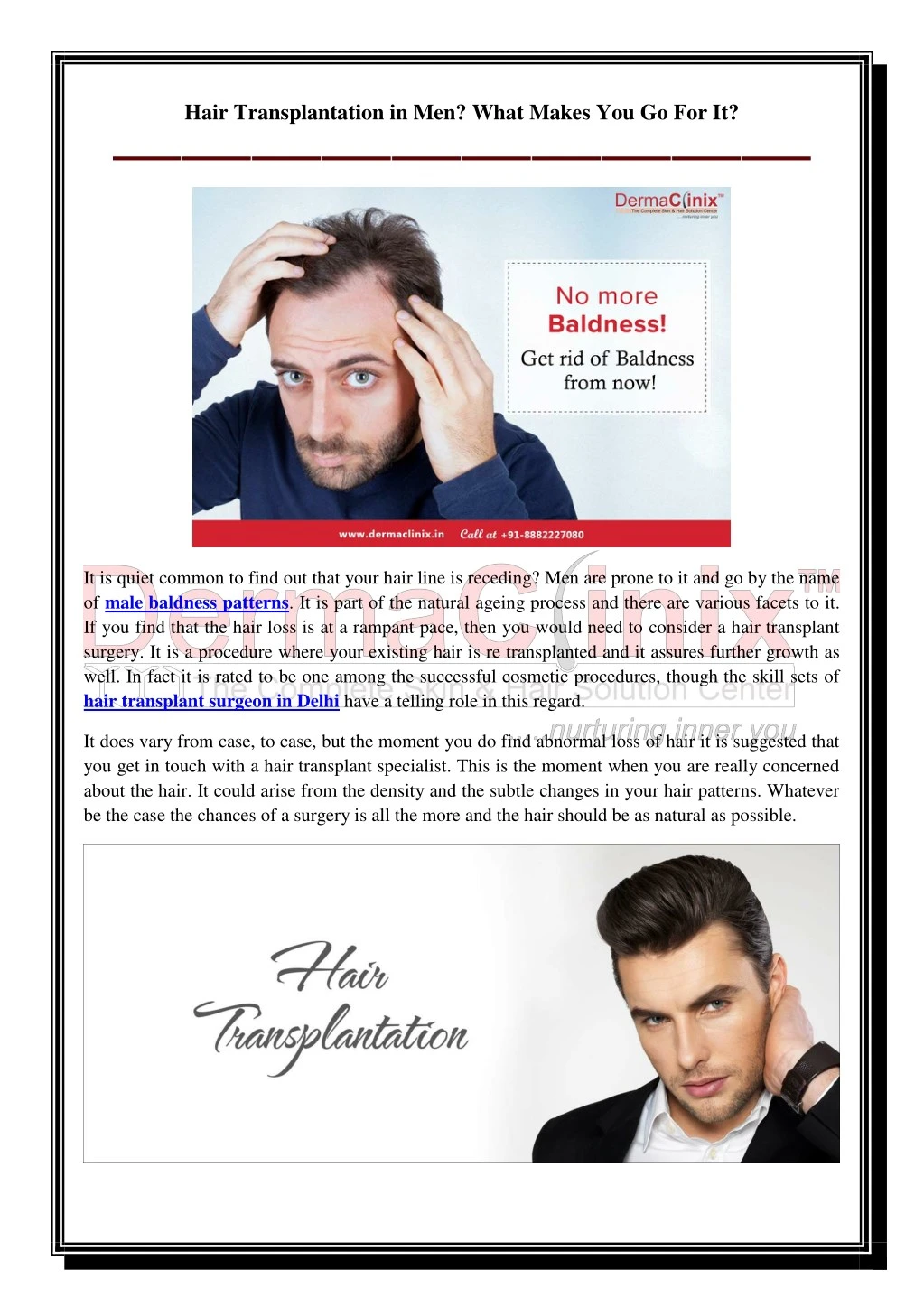 hair transplantation in men what makes