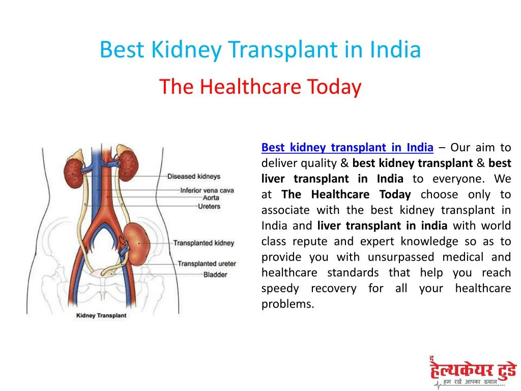 best kidney transplant in india