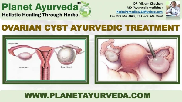 Ovarian Cyst - Types, Causes, Symptoms & Ayurvedic Treatment