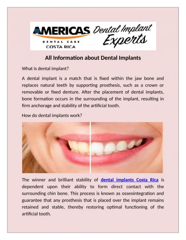 Dental implants are one of the most common procedures performed on dental tourists in Costa Rica.