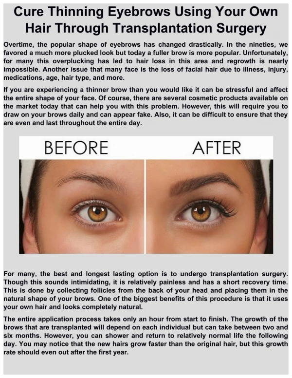 Cure thinning eyebrows using your own hair through transplantation surgery