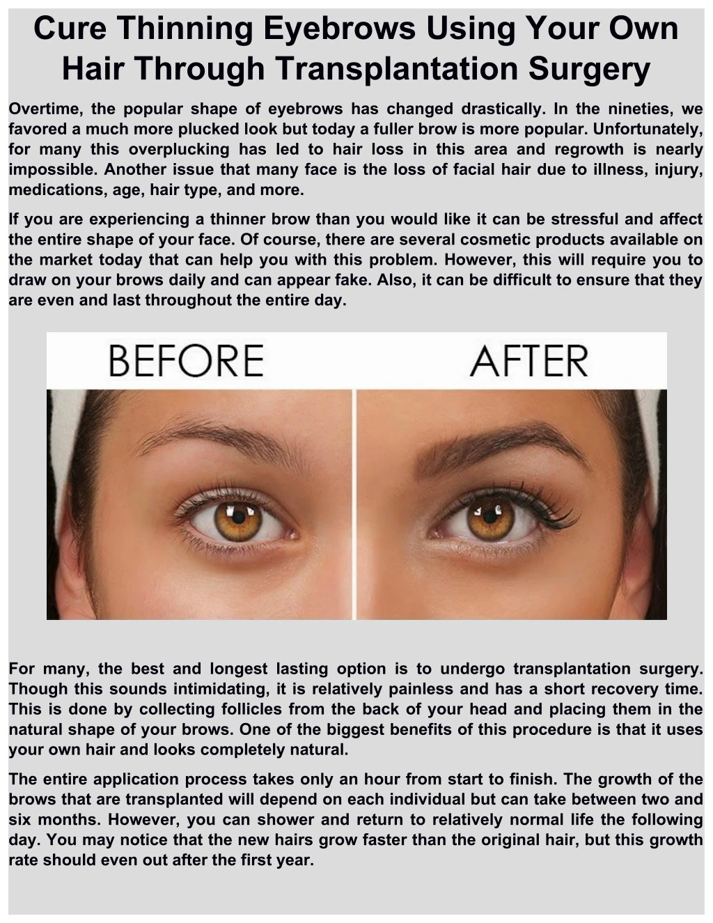 cure thinning eyebrows using your own hair