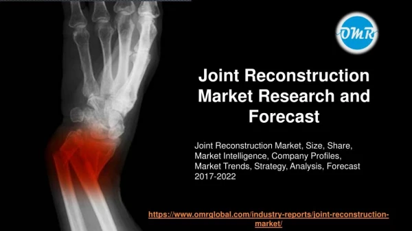 Joint Reconstruction Market Research and Forecast