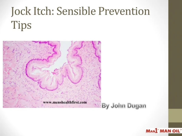 Jock Itch: Sensible Prevention Tips