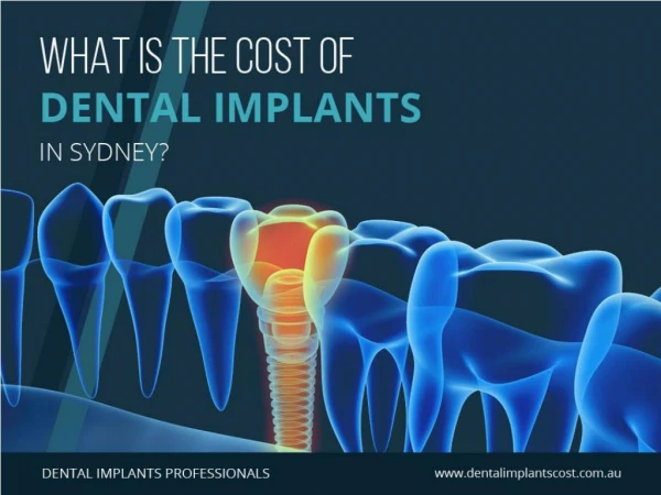 What Is the Cost of Dental Implants in Sydney?